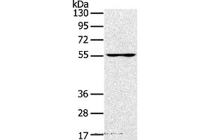 Western blot analysis of PC3 cell, using UBP1 Polyclonal Antibody at dilution of 1:200 (UBP1 抗体)