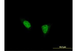 Immunofluorescence of monoclonal antibody to TSHZ1 on HeLa cell. (TSHZ1 抗体  (AA 619-717))