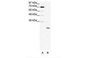 Image no. 1 for anti-Inhibitor of DNA Binding 4, Dominant Negative Helix-Loop-Helix Protein (ID4) (N-Term) antibody (ABIN202035)