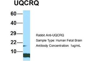 Western Blotting (WB) image for anti-Ubiquinol-Cytochrome C Reductase, Complex III Subunit VII, 9.5kDa (UQCRQ) (Middle Region) antibody (ABIN2790714)