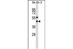 Western blot analysis in SK-BR-3 cell line lysates (35ug/lane). (GNAI2 抗体  (N-Term))