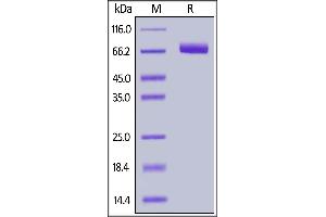 Human EphA4, His Tag on  under reducing (R) condition. (EPH Receptor A4 Protein (EPHA4) (AA 20-547) (His tag))