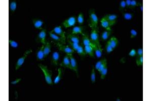 Immunofluorescence staining of Hela cells with ABIN7166409 at 1:133, counter-stained with DAPI. (Transglutaminase 2 抗体  (AA 4-544))