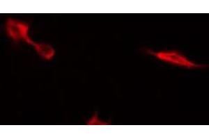 Immunofluorescence (fixed cells) (IF/ICC) image for anti-Met Proto-Oncogene (MET) (C-Term) antibody (ABIN6263229)