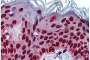 Human Skin (formalin-fixed, paraffin-embedded) stained with SLC35A5 antibody ABIN462241 followed by biotinylated goat anti-rabbit IgG secondary antibody ABIN481713, alkaline phosphatase-streptavidin and chromogen. (SLC35A5 抗体  (AA 36-85))