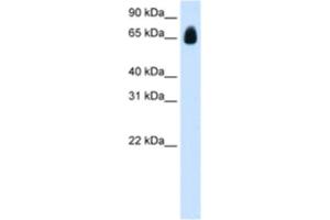 Western Blotting (WB) image for anti-Tripartite Motif Containing 32 (TRIM32) antibody (ABIN2461828) (TRIM32 抗体)
