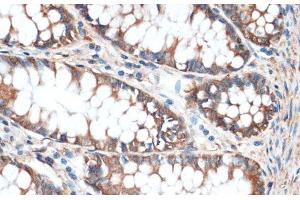Immunohistochemistry of paraffin-embedded Human colon using Aquaporin 4 Polyclonal Antibody at dilution of 1:100 (40x lens). (Aquaporin 4 抗体)