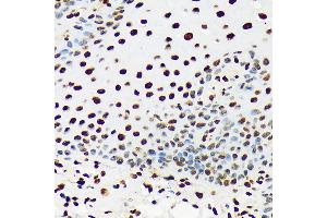Immunohistochemistry (IHC) image for anti-DEAD (Asp-Glu-Ala-Asp) Box Polypeptide 39B (DDX39B) antibody (ABIN7266696)