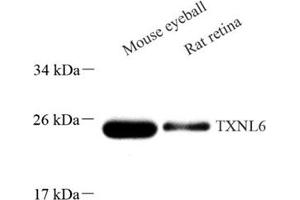 Western blot analysis of TXNL6 (ABIN7074917) at dilution of 1: 500 (NXNL1 抗体)