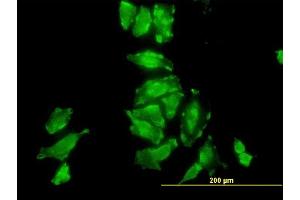 Immunofluorescence (IF) image for anti-Proteasome (Prosome, Macropain) 26S Subunit, Non-ATPase, 10 (PSMD10) (AA 127-226) antibody (ABIN562495)