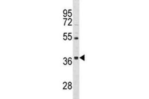 ORAI3 antibody western blot analysis in HepG2 lysate. (ORAI3 抗体  (AA 1-30))