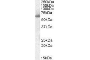 ABIN2559909 (0. (SH2D3A 抗体  (Internal Region))