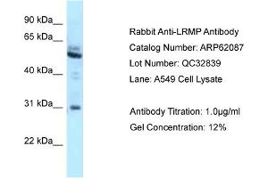 Western Blotting (WB) image for anti-Lymphoid-Restricted Membrane Protein (LRMP) (C-Term) antibody (ABIN971075) (LRMP 抗体  (C-Term))
