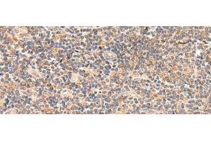 Immunohistochemistry of paraffin-embedded Human tonsil tissue using TEAD3 Polyclonal Antibody at dilution of 1:50(x200) (TEAD3 抗体)