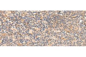 Immunohistochemistry of paraffin-embedded Human tonsil tissue using TEAD3 Polyclonal Antibody at dilution of 1:50(x200) (TEAD3 抗体)