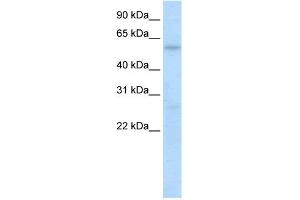WB Suggested Anti-HIC2 Antibody Titration:  0. (HIC2 抗体  (N-Term))