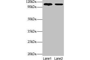 Western blot All lanes: EXTL3 antibody at 2 μg/mL Lane 1: EC109 whole cell lysate Lane 2: 293T whole cell lysate Secondary Goat polyclonal to rabbit IgG at 1/15000 dilution Predicted bane side: 105 kDa Observed band side: 105 kDa (EXTL3 抗体  (AA 2-245))