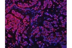 IF analysis of TFEB using anti-TFEB antibody (ABIN7600648). (TFEB 抗体  (AA 214-326))