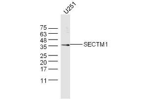 U251 lysate probed with Anti-SECTM1 Polyclonal Antibody  at 1:5000 90min in 37˚C. (SECTM1 抗体  (AA 42-150))