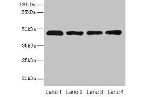 Western blot All lanes: ZDHHC23 antibody at 8 μg/mL Lane 1: 293T whole cell lysate Lane 2: Mouse brain tissue Lane 3: A549 whole cell lysate Lane 4: Human placenta tissue Secondary Goat polyclonal to rabbit IgG at 1/10000 dilution Predicted band size: 46 kDa Observed band size: 46 kDa (ZDHHC23 抗体  (AA 187-302))