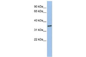 Western Blotting (WB) image for anti-PHD Finger Protein 13 (PHF13) antibody (ABIN2459472) (PHF13 抗体)