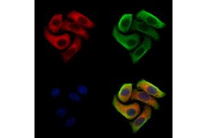 ABIN7094421 and ABIN7098468 staining Hela cells by IF/ICC. (Clathrin 抗体  (C-Term))