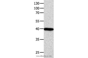 Western blot analysis of 293T cell  , using FOXL1  Polyclonal Antibody at dilution of 1:850 (FOXL1 抗体)