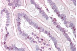 Human Small Intestine (formalin-fixed, paraffin-embedded) stained with RTEL1 antibody ABIN334244 at 5 ug/ml followed by biotinylated goat anti-rabbit IgG secondary antibody ABIN481713, alkaline phosphatase-streptavidin and chromogen. (RTEL1 抗体  (N-Term))