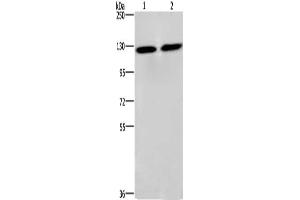Gel: 6 % SDS-PAGE, Lysate: 40 μg, Lane 1-2: PC3 cells, lovo cells, Primary antibody: ABIN7128916(CEP97 Antibody) at dilution 1/750, Secondary antibody: Goat anti rabbit IgG at 1/8000 dilution, Exposure time: 3 seconds (CEP97 抗体)