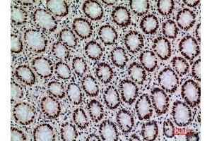 Immunohistochemistry (IHC) image for anti-Signaling Lymphocytic Activation Molecule Family Member 1 (SLAMF1) (Tyr1096) antibody (ABIN3187802)