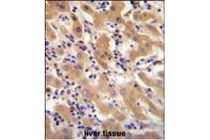 F11 Antibody (Center) (ABIN655515 and ABIN2845030) immunohistochemistry analysis in formalin fixed and paraffin embedded human liver tissue followed by peroxidase conjugation of the secondary antibody and DAB staining. (Factor XI 抗体  (AA 281-307))