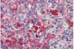 Immunohistochemistry (Paraffin-embedded Sections) (IHC (p)) image for anti-GATA Binding Protein 6 (GATA6) (C-Term) antibody (ABIN462170)