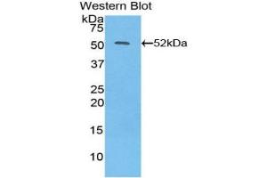 Detection of Recombinant IFNb, Human using Polyclonal Antibody to Interferon Beta (IFNb) (IFNB1 抗体  (AA 22-187))