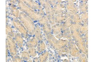 Phospho-PERK (Ser715) Antibody at 1/100 staining Mouse kidney tissue by IHC-P.