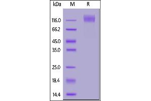 SDS-PAGE (SDS) image for Carcinoembryonic Antigen-Related Cell Adhesion Molecule 5 (CEACAM5) (AA 35-685) (Active) protein (His tag,FITC) (ABIN6973027)