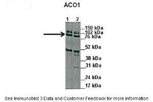 Western Blotting (WB) image for anti-Aconitase 1 (ACO1) (N-Term) antibody (ABIN2778793)