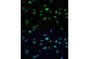 Immunofluorescence analysis of U-2 OS cells using MDC1 antibody (ABIN6131721, ABIN6143660, ABIN6143662 and ABIN6224387) at dilution of 1:100. (MDC1 抗体  (AA 1-350))