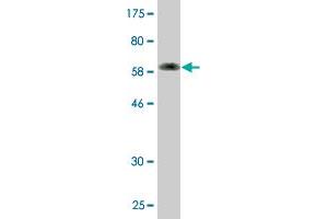 Western Blotting (WB) image for anti-ATPase, H+ Transporting, Lysosomal 38kDa, V0 Subunit D1 (ATP6V0D1) (AA 1-351) antibody (ABIN522570)