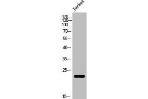 Western Blot analysis of Jurkat cells using AKAP 14 Polyclonal Antibody (AKAP14 抗体  (N-Term))