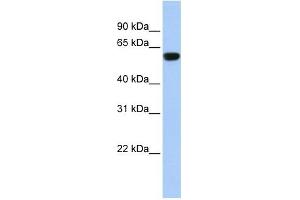 TRIM72 antibody used at 1 ug/ml to detect target protein. (TRIM72 抗体  (Middle Region))