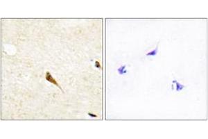 Immunohistochemistry analysis of paraffin-embedded human brain tissue, using MOK Antibody. (MOK 抗体  (AA 261-310))