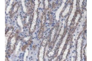 Detection of RIPK2 in Mouse Kidney Tissue using Polyclonal Antibody to Receptor Interacting Serine Threonine Kinase 2 (RIPK2) (RIPK2 抗体  (AA 1-294))