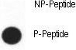 Dot blot analysis of phospho-CDX2 antibody. (CDX2 抗体  (pSer283))