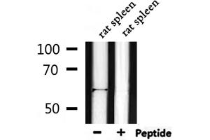 Western Blotting (WB) image for anti-V-Akt Murine Thymoma Viral Oncogene Homolog 1 (AKT1) (pThr450) antibody (ABIN6256564)