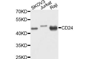 Western blot analysis of extracts of various cells, using CD24 antibody. (CD24 抗体)