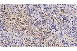Immunohistochemistry (IHC) image for anti-Alanine Aminotransferase (ALT) (AA 367-480) antibody (ABIN7429409)