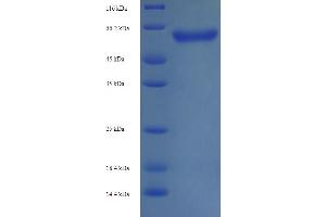 SDS-PAGE (SDS) image for Neurofilament, Light Polypeptide (NEFL) (AA 2-543) protein (His tag) (ABIN5713696)
