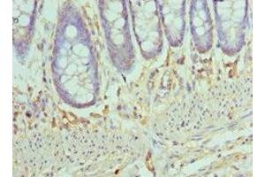 Immunohistochemistry of paraffin-embedded human colon tissue using ABIN7145996 at dilution of 1:100 (CCL28 抗体  (AA 20-127))