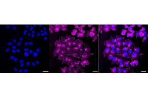 anti-Caveolin 2 (CAV2) antibody