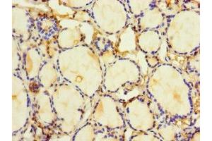Immunohistochemistry of paraffin-embedded human thyroid tissue using ABIN7155301 at dilution of 1:100 (HDAC1 抗体  (AA 1-482))